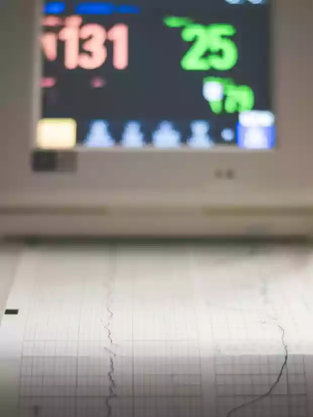 tmt stress test