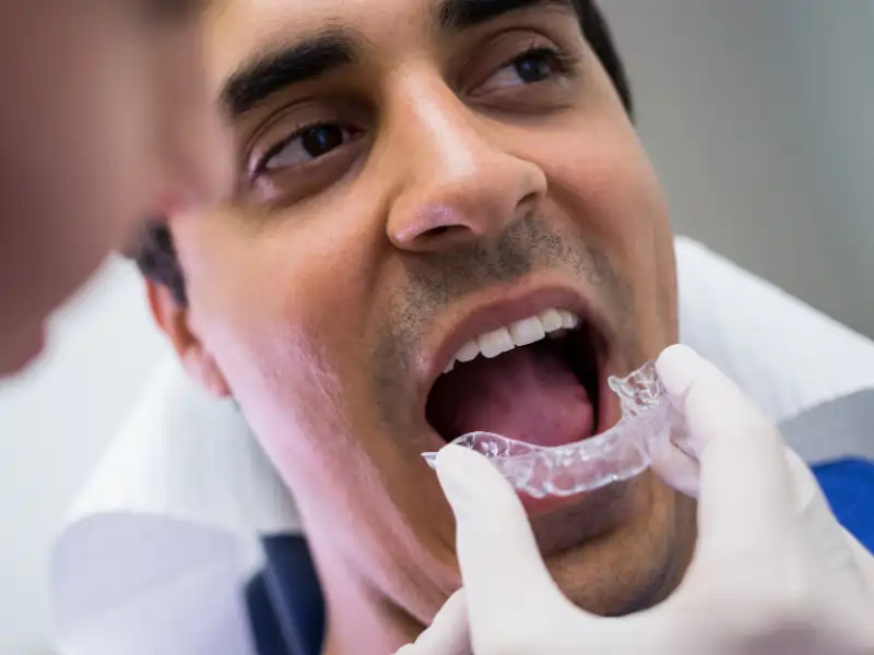 Dental Alignment Lagos