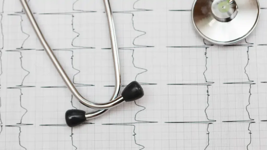 Electrocardiogram lagos