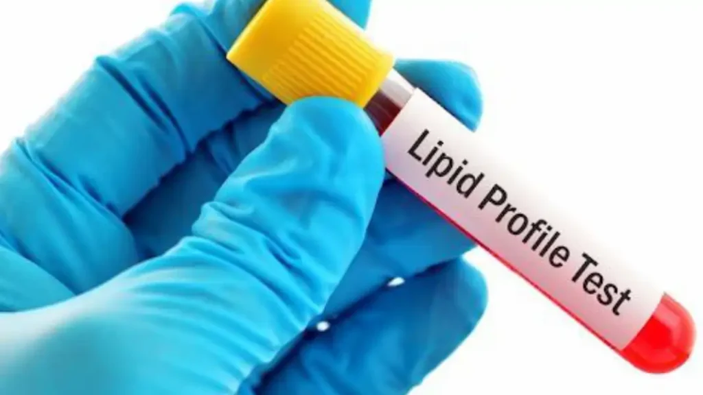 Lipid Profile test vicctoria islands