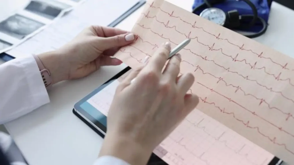 ecg