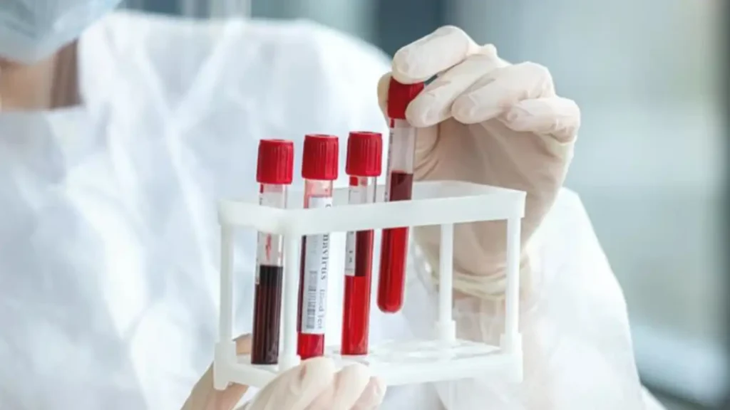 laboratory test