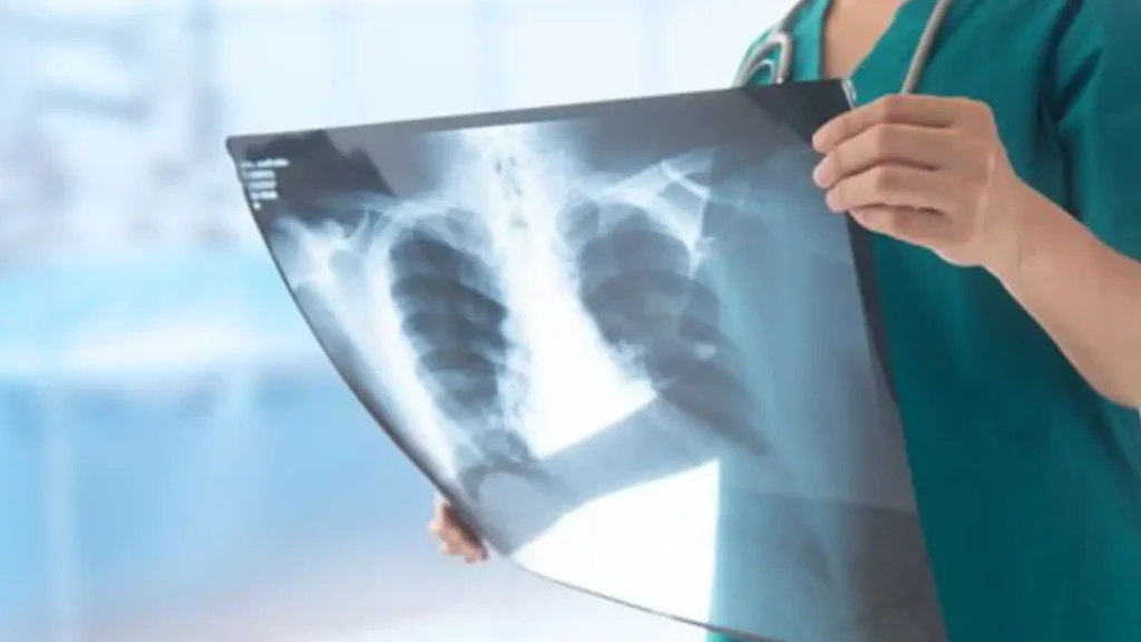 xray