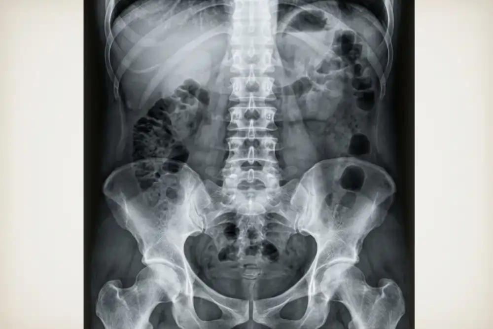 abdominal xray victoria island lagos 1