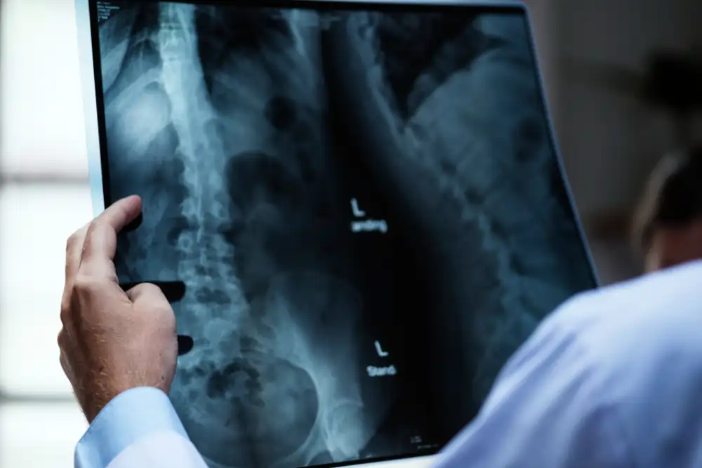 spine xray victoria islands